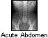 Abdomen Image