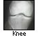 Knee X-Ray Image